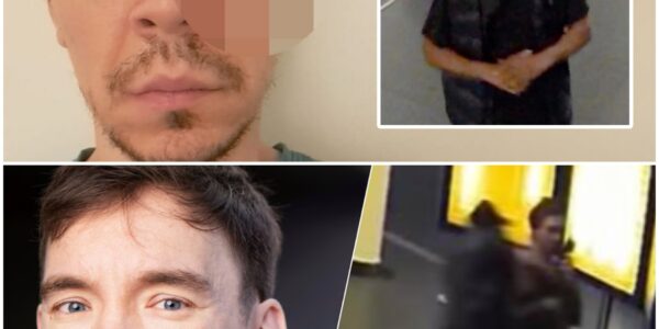 Er zijn beelden vrijgegeven van komiek Fabian Franciscus, die op Amsterdam Centraal door een immigrant-verdachte in zijn oog werd geslagen.